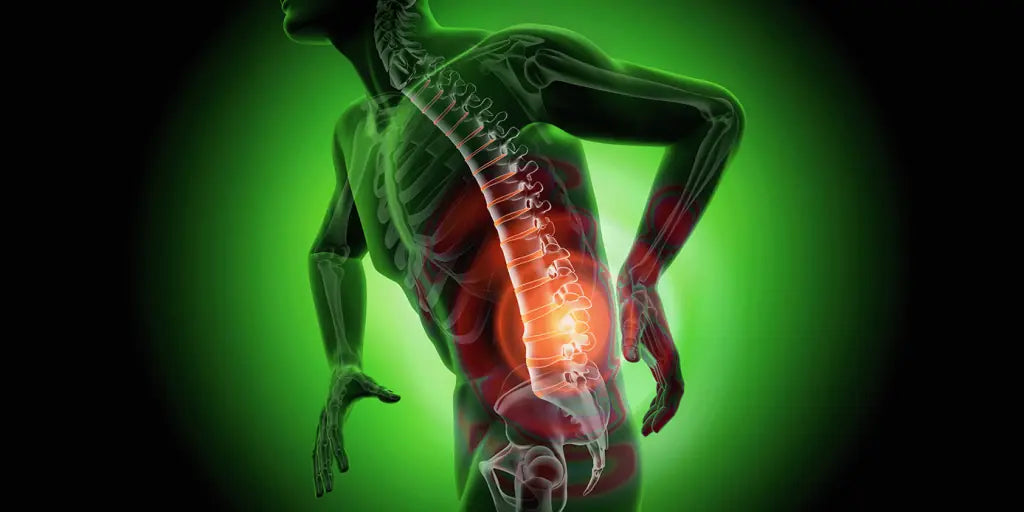 CBD Wundermittel gegen Rückenschmerzen|CBD-Rückenschmerzen||